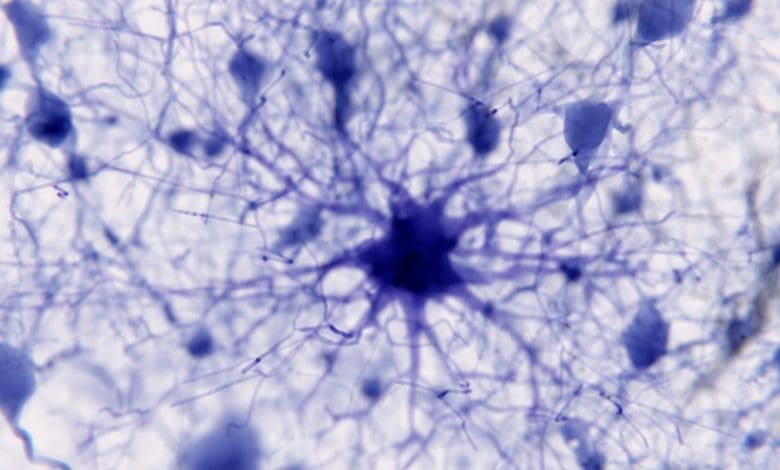 Melampaui Neuron: Sel Otak Ini Dapat Mengubah Cara Kita Mengobati Penyakit Mental Melampaui Neuron: Sel Otak Ini Dapat Mengubah Cara Kita Mengobati Penyakit Mental