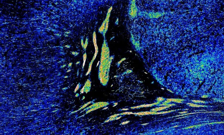 Perkembangan Otak Berlanjut Jauh Setelah Kelahiran, Temuan Penelitian Perkembangan Otak Berlanjut Jauh Setelah Kelahiran, Temuan Penelitian