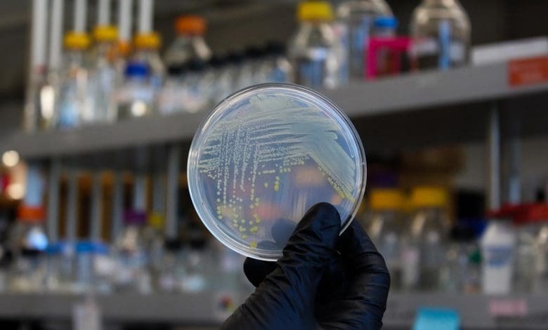 Jaringan Rahasia Tanah: Bagaimana Mikroba Berbagi Sumber Daya Jaringan Rahasia Tanah: Bagaimana Mikroba Berbagi Sumber Daya