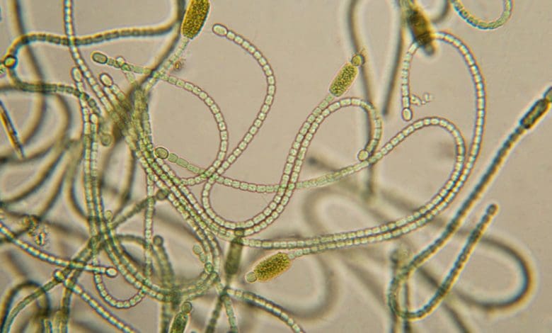 Peneliti Stanford Mengungkap Rahasia Genetik pada Cyanobacteria yang Dapat Mengubah Penyimpanan Karbon Peneliti Stanford Mengungkap Rahasia Genetik pada Cyanobacteria yang Dapat Mengubah Penyimpanan Karbon