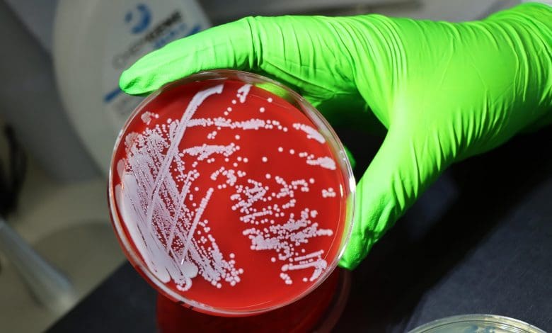 Terobosan Genetik mengungkapkan bagaimana Superbugs mengakali pertahanan kami Terobosan Genetik mengungkapkan bagaimana Superbugs mengakali pertahanan kami